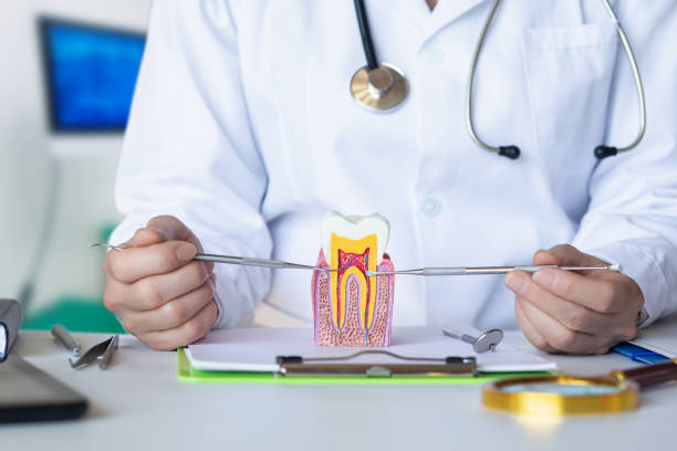 Best Knocked-Out Tooth (Avulsed Tooth) Treatment in Bethel, WA