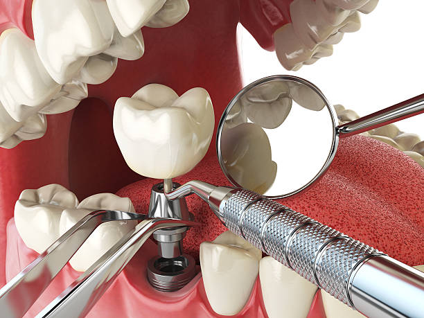 Best Walk-In Emergency Dental Services in Bethel, WA